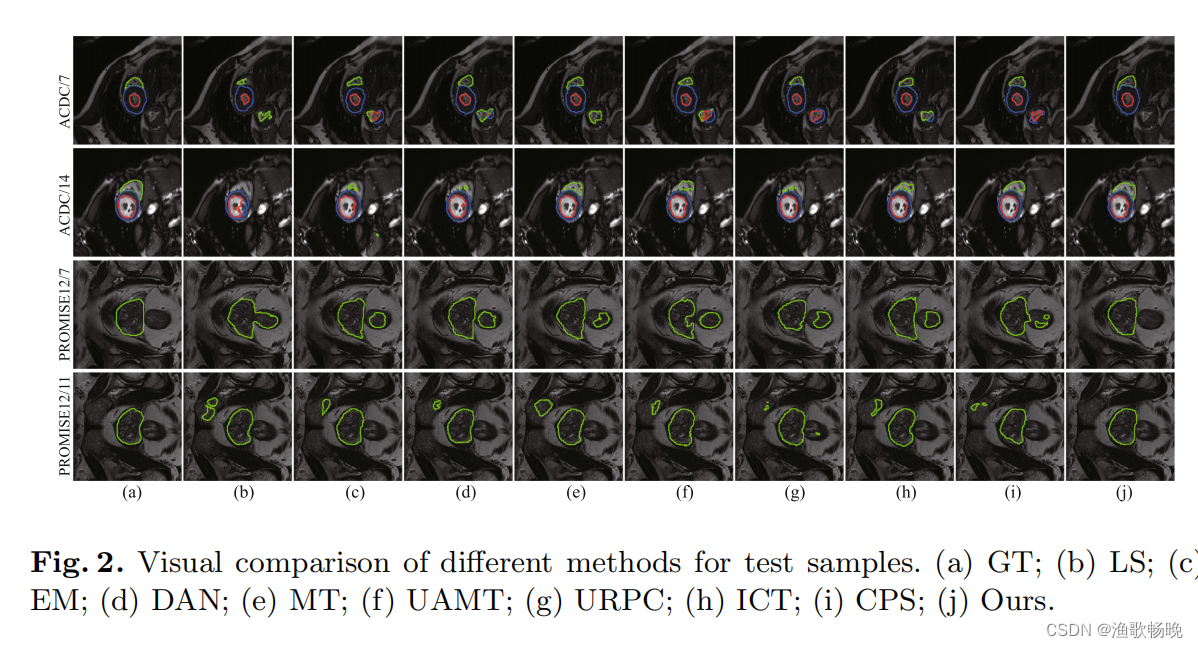 《Semi-supervised Medical Image Segmentation Using Cross-Model Pseudo ...