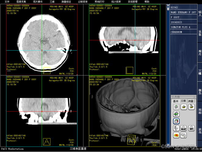 三维后处理与重建PACS源码，大容量图像存储 报告单多种模式及自定义样式