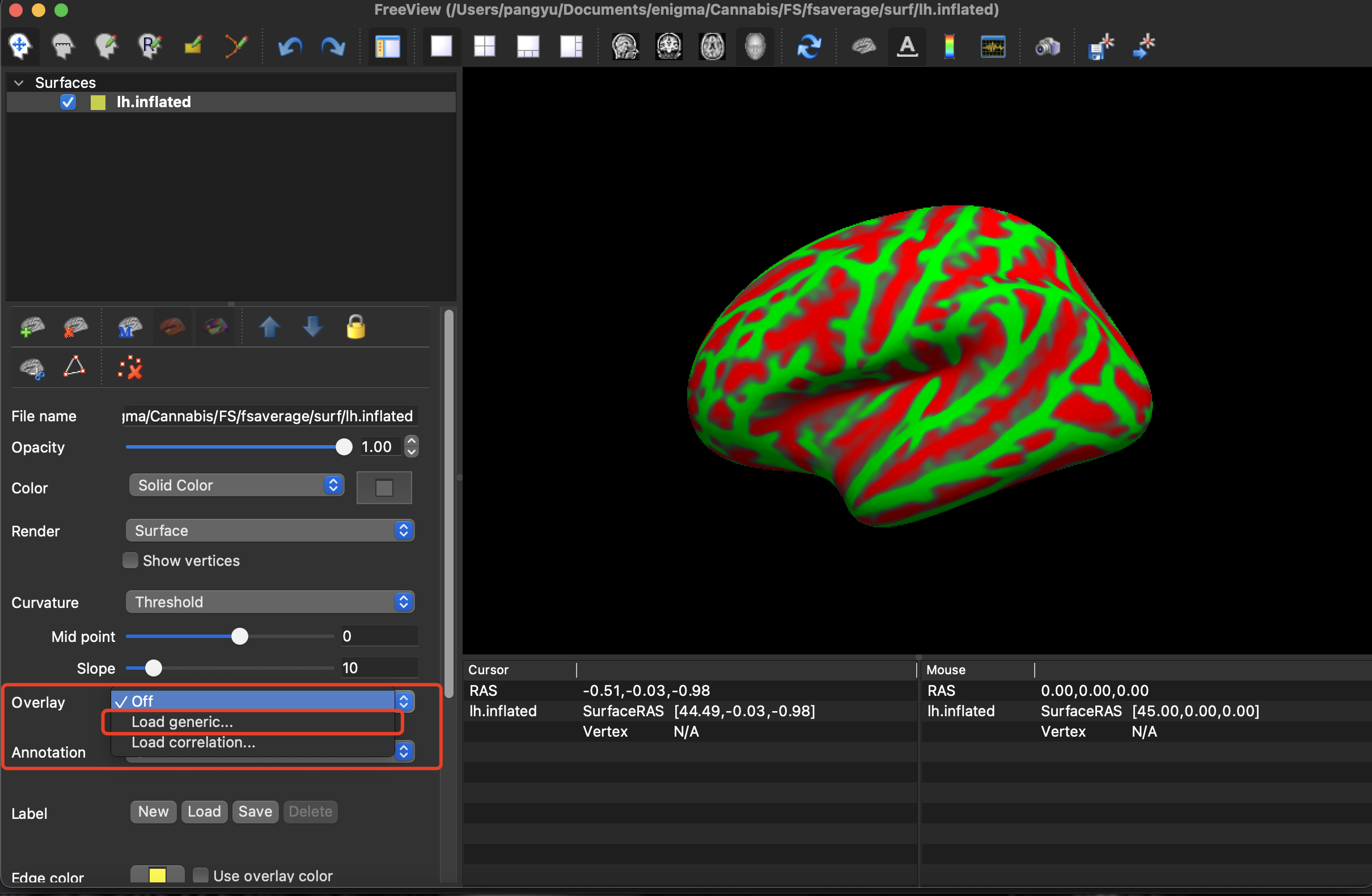 Freesurfer_T1_组分析-02（可视化）_freesurfer组分析-CSDN博客