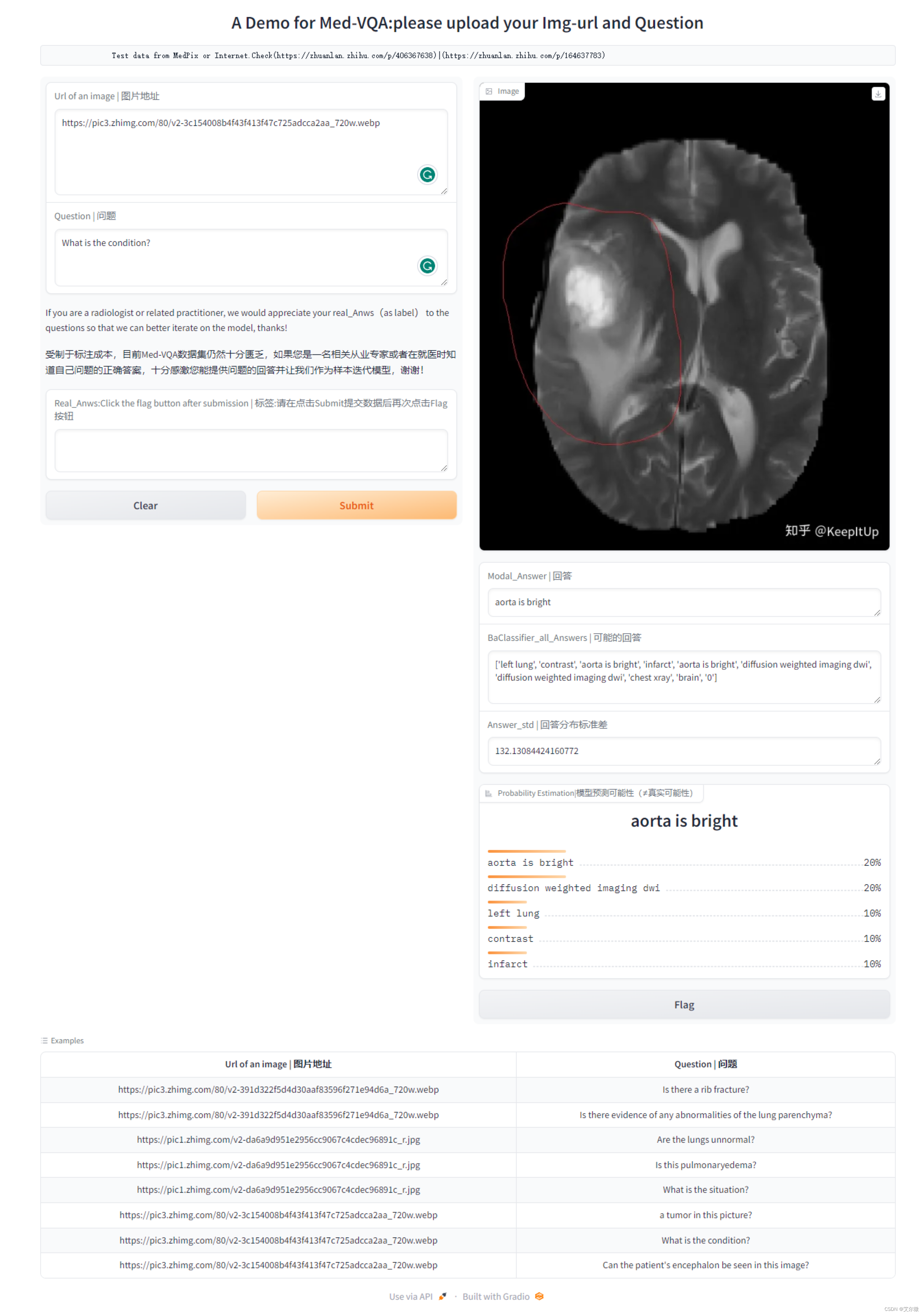 [新人自制/Med-VQA] 这是一个可以帮忙看“片子“的 AI-Demo，欢迎大神来访留言