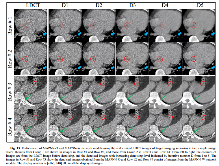 Low-dose CT Image Synthesis for Domain Adaptation Imaging Using a ...