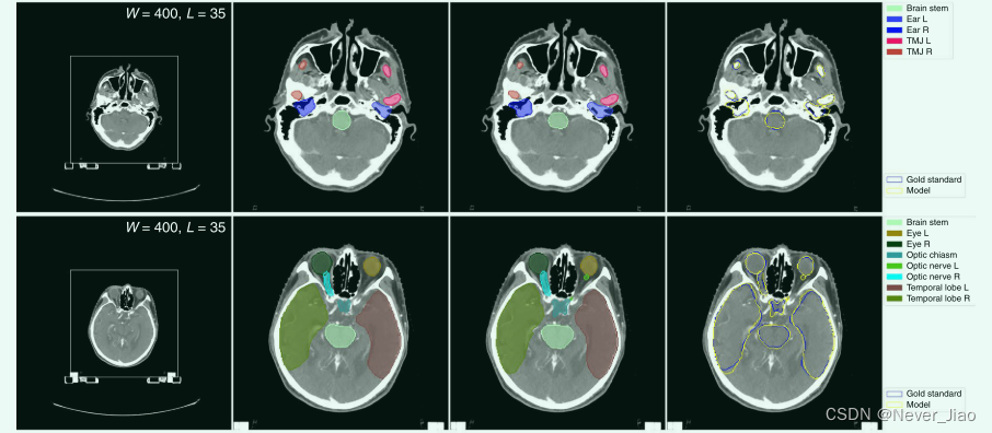 Clinically applicable deep learning framework for organs at risk ...