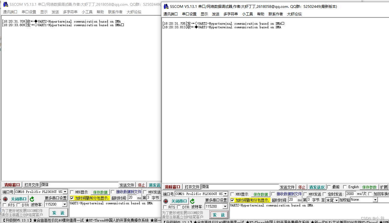 STM32CubeMX：串口DMA