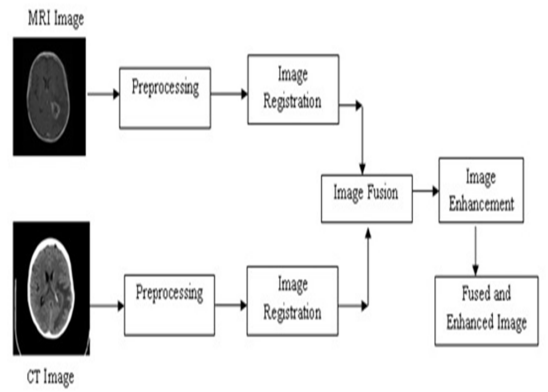 Framework for Multimodal Image Fusion for Detection of Glioblastoma