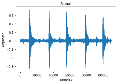 理解梅尔频谱（mel spectrogram）