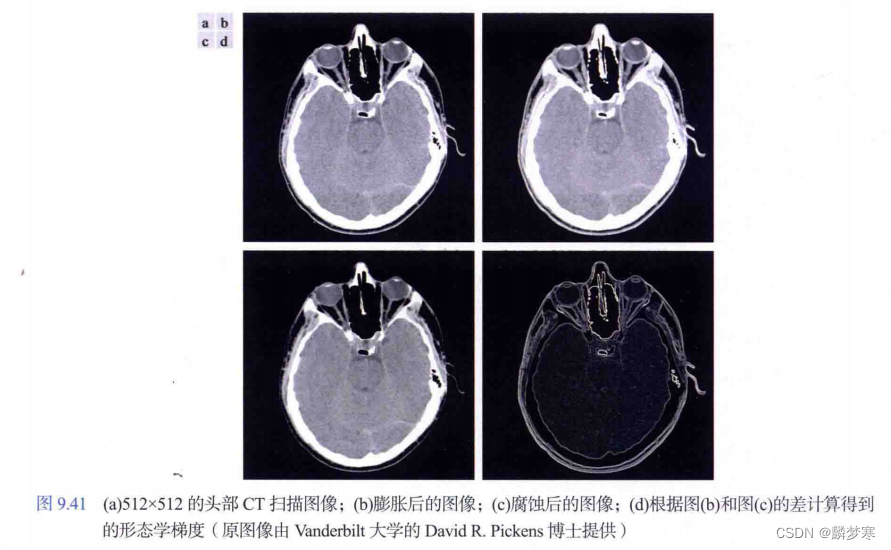 形态学梯度