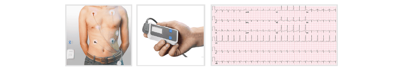 twelve lead holter monitor 0