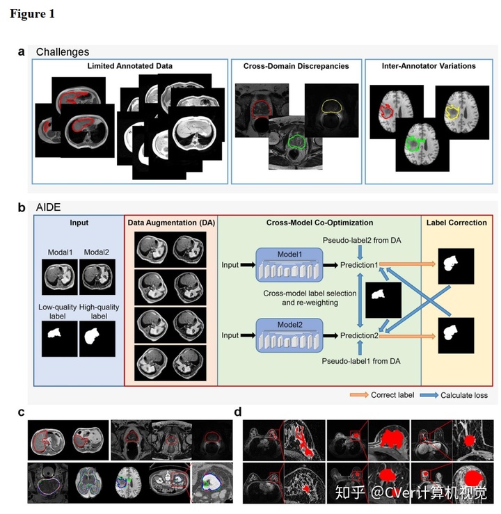 bp算法用于图像分割aide用于自动医学图像分割的注释高效深度学习