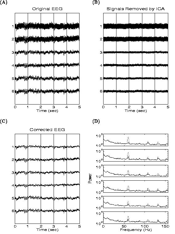 ICA独立成分分析去除脑电伪影