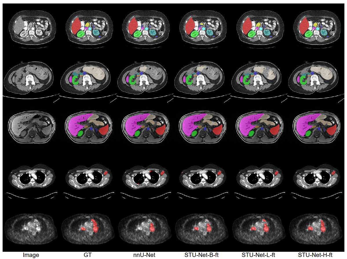 Figure 3. Visual comparison of STU-Net and nnU-Net at different scales on various medical imaging datasets