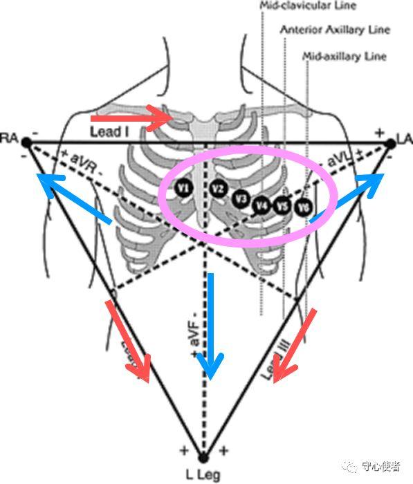 心电图四肢导联英文图片