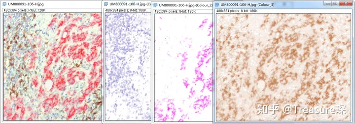 ImageJ灰度值量化分析 实用技巧——免疫组化分析(定量分析篇)