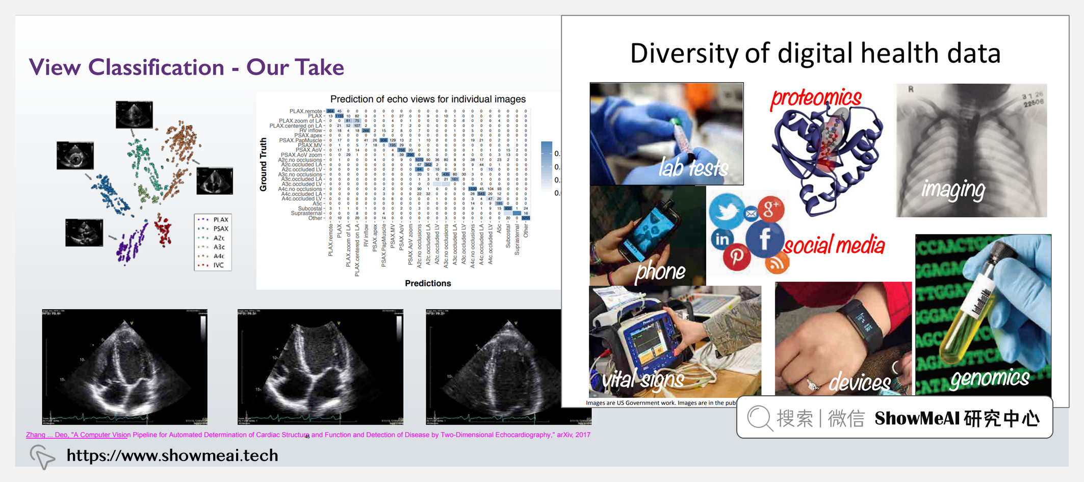 6.S897; Machine Learning for Healthcare; 医疗机器学习