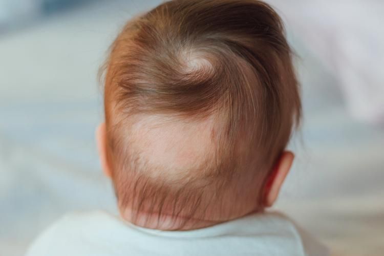 新生儿枕秃：原因、科普和注意事项