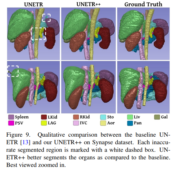 超越nnFormer！UNETR++：高效准确的3D医学图像分割