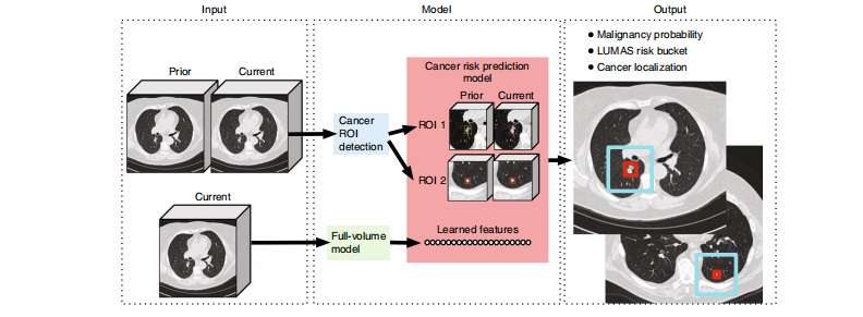 <span style='color:red;'>文献</span>速递：<span style='color:red;'>肺癌</span>早期诊断---低剂量胸部计算机断层扫描上的三维深度学习端到端<span style='color:red;'>肺癌</span>筛查