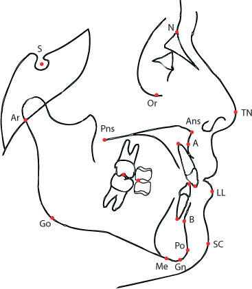 reference points