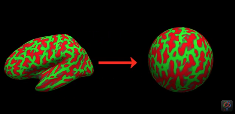 freesurfer全过程梳理-CSDN博客