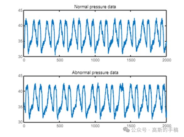 基于自编码器的时间序列异常检测方法（以传感器数据为例，MATLAB R2021b）