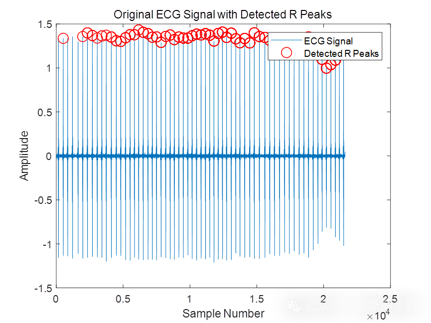 基于双差分值和RR间隔处理的心电信号R峰检测算法（MATLAB R2018A）