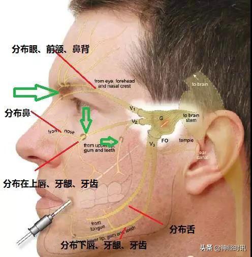 上项线体表位置_体表神经解剖:三叉神经详解