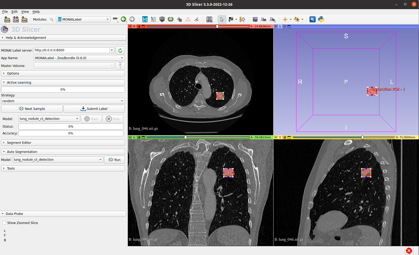 在3D Slicer中使用 Monai Bundle 和 Model Zoo 标注医学影像数据-CT肺结节检测_3D
