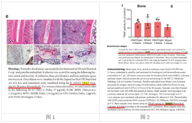 经众多Nature文章使用认证！艾美捷抗酒石酸酸性磷酸酶TRAP染色试剂盒