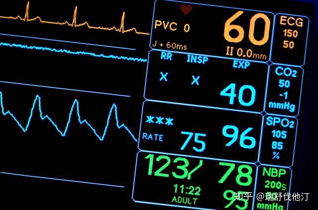 删除低于60分的记录每分钟心跳低于60正常吗不瞒你说老人心率在这个