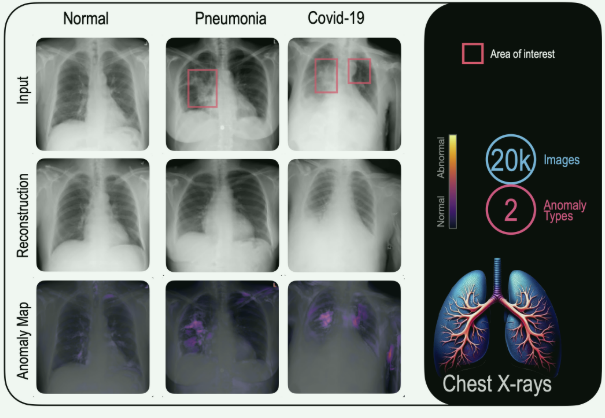 【论文阅读笔记】Towards Universal Unsupervised Anomaly Detection in Medical Imaging