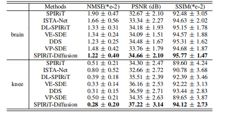 SPIRiT-Diffusion：基于自一致性驱动的加速MRI扩散模型|文献速递-基于深度学习的病灶分割与数据超分辨率