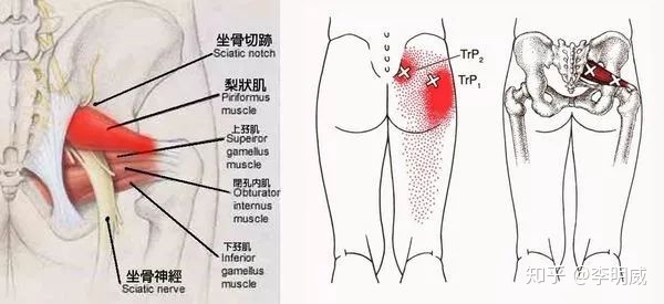 骶髂关节错位症状图片