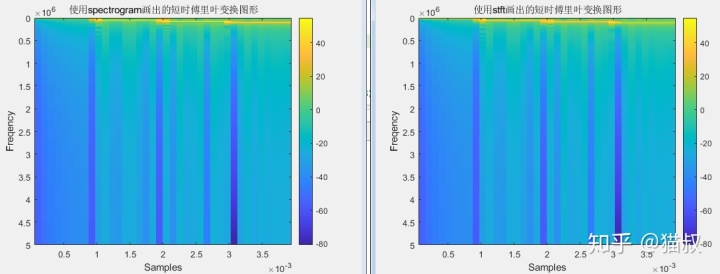 MATLAB 长度和像素_Matlab中短时傅里叶变换 spectrogram和stft的用法
