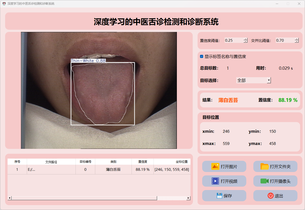 深度学习的中医舌诊检测诊断系统研究与实现(PyQt5界面+数据集+训练代码)_基于深度学习的舌诊-CSDN博客