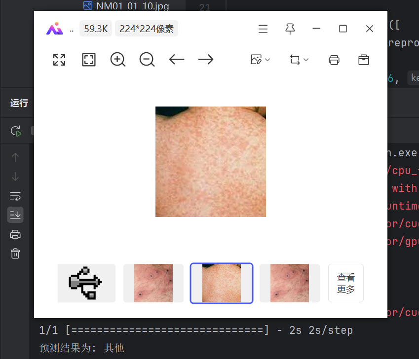 第T4周：TensorFlow实现猴痘识别