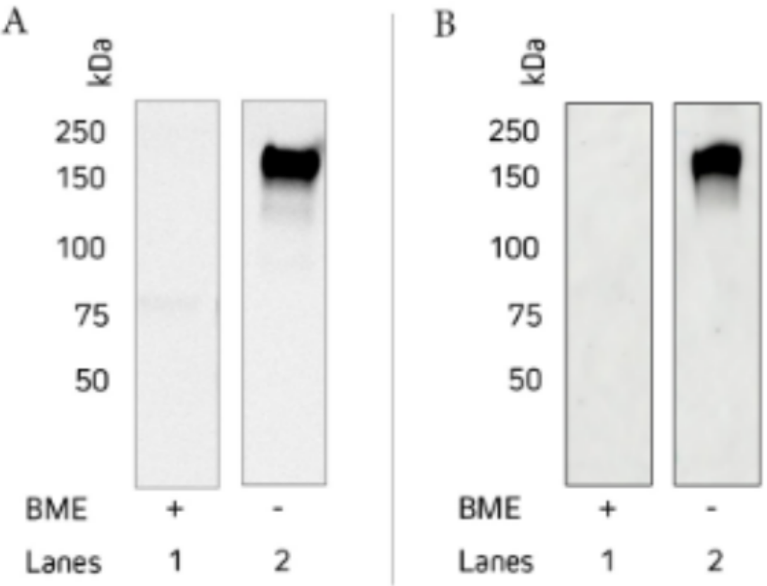 Jackson精品推荐——Anti-Human IgE Antibodies