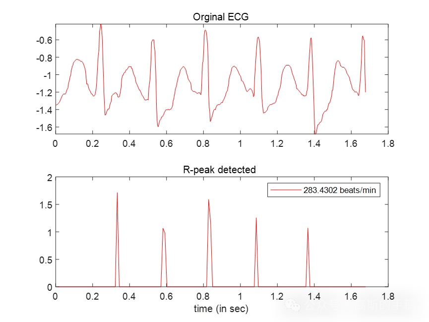 基于小波熵阈值的心电信号R波检测算法（MATLAB）