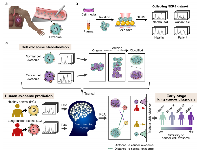 <span style='color:red;'>文献</span>速递：<span style='color:red;'>肺癌</span>早期诊断---早期<span style='color:red;'>肺癌</span>诊断：基于深度学习的循环外泌体光谱分析