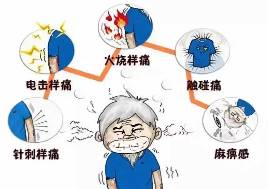 名医高效良方(三叉神经痛)