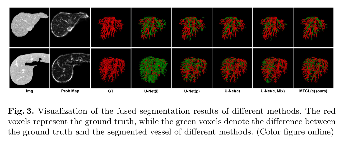 Visualization of the fused segmentation results of different methods.png