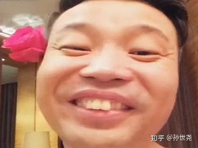 只做两个龅牙门牙大门牙的王迅为什么不整牙