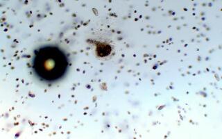 显微镜下漂白粉、洗洁精、消毒水、小苏打、食盐等对鞭毛虫、细菌的杀伤力对比