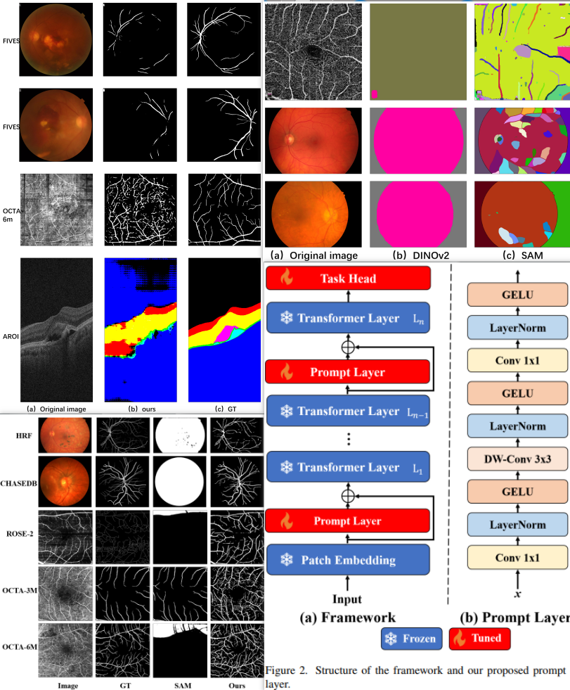 Learnable Ophthalmology SAM