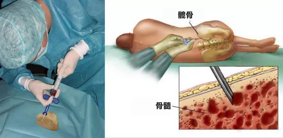 细胞专刊pbmc人骨髓单个核细胞