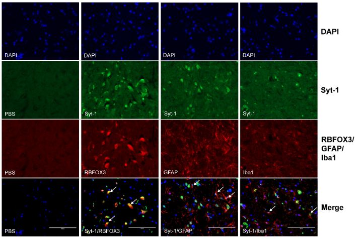 转化医学明星靶点-星型胶质细胞标志物gfap-易微帮