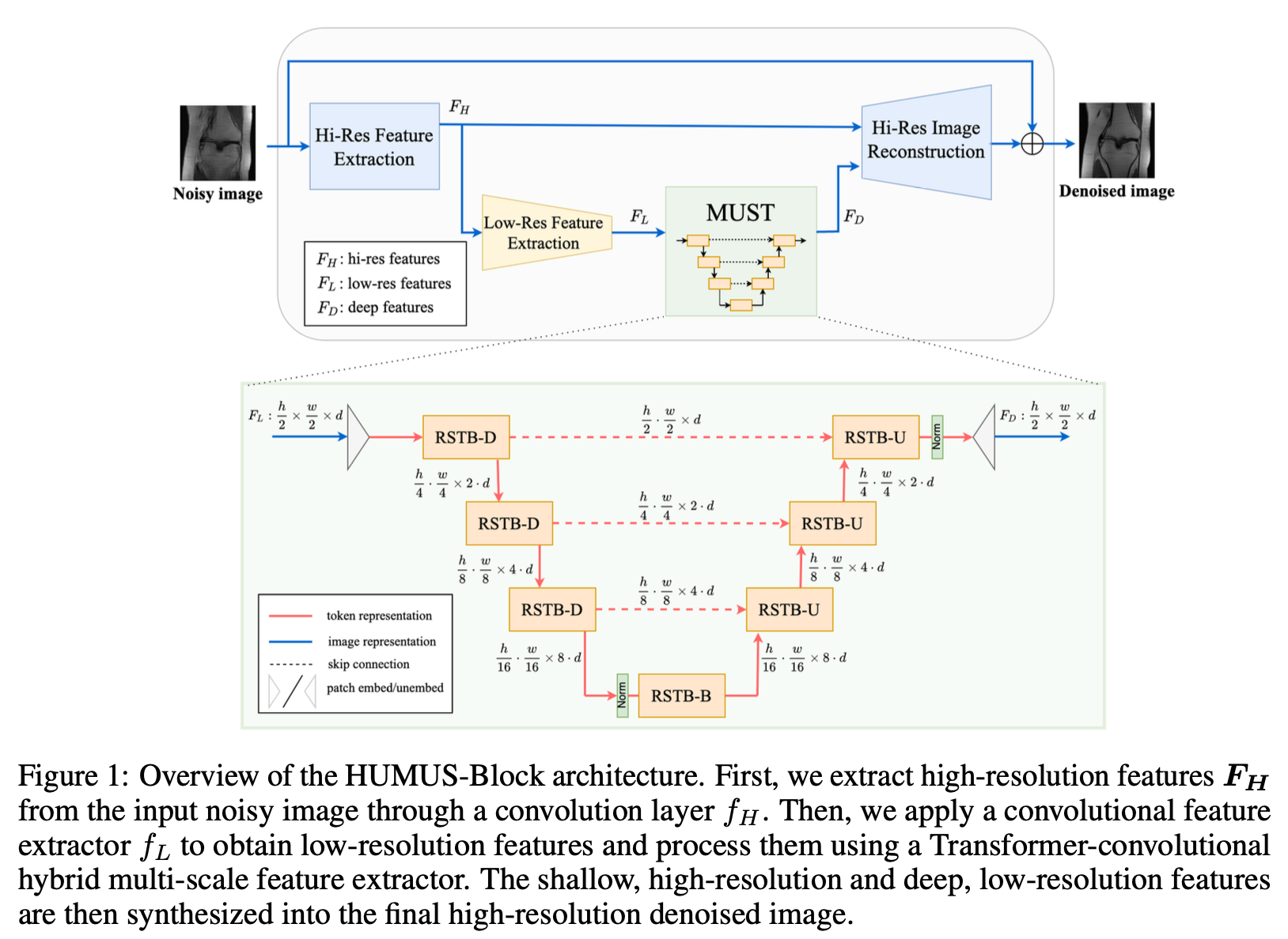 NeurIPS 2022 | HUMUS-Net：用于加速MRI重建的混合展开多尺度网络结构