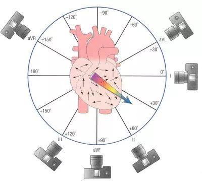 心电轴怎么画图片