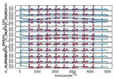 Unet<span style='color:red;'>心</span><span style='color:red;'>电信号</span>分割方法（<span style='color:red;'>Pytorch</span>）