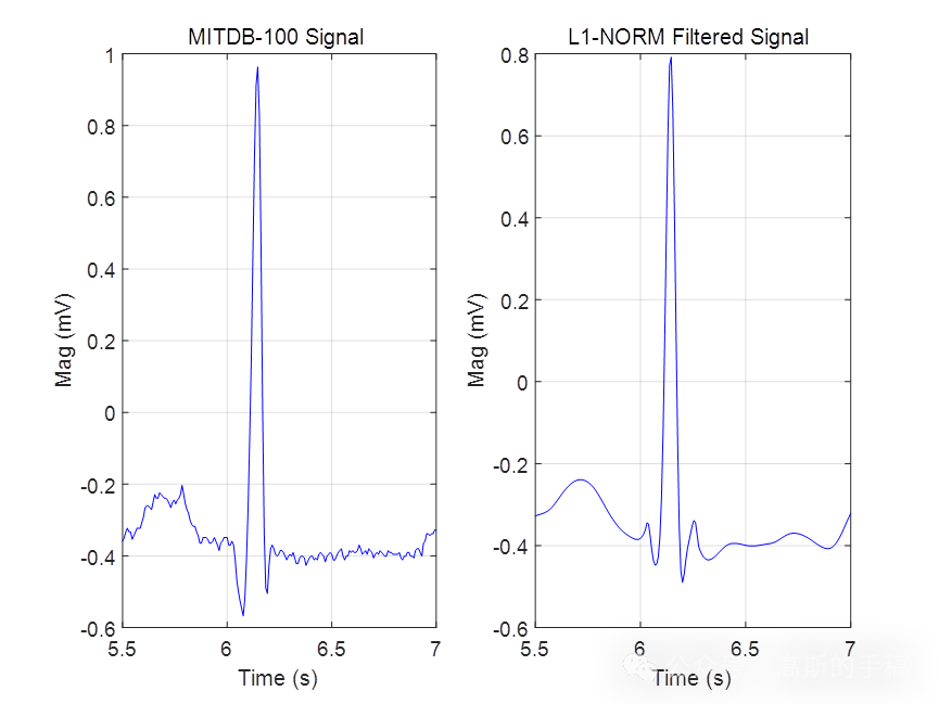 基于L1范数惩罚的稀疏正则化最小二乘心电信号降噪方法（Matlab R2021B）