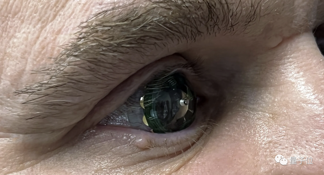ar隐形眼镜来了,一部手机的价格,正式开启人体佩戴测试