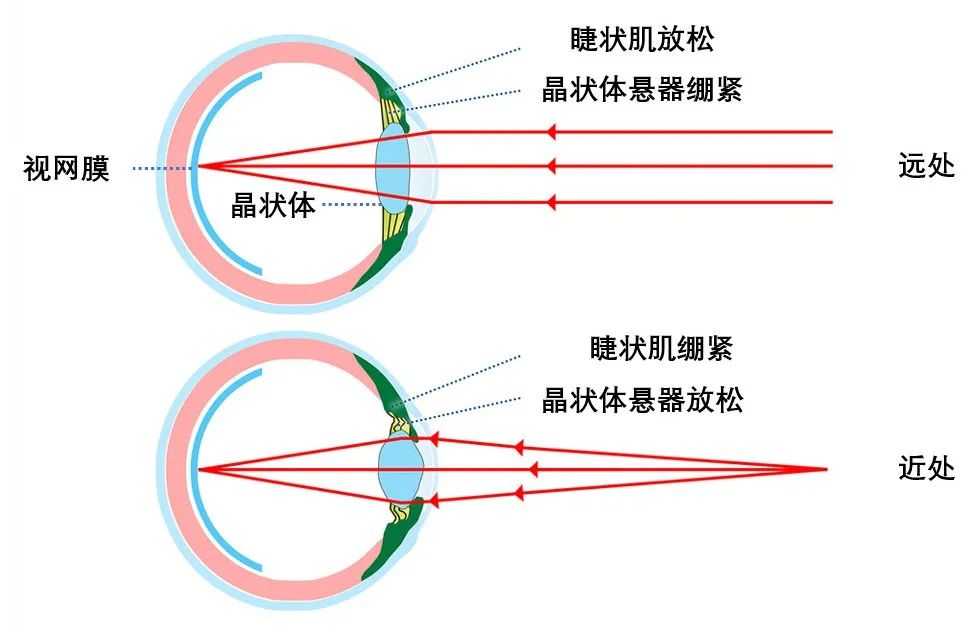 睫状肌收缩原理图片